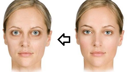 دلیل بیرون زدگی چشم ها از کاسه چشم چیست؟