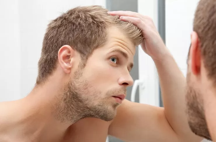 جلوگیری از ریزش مو در مردان با بهترین روش ها
