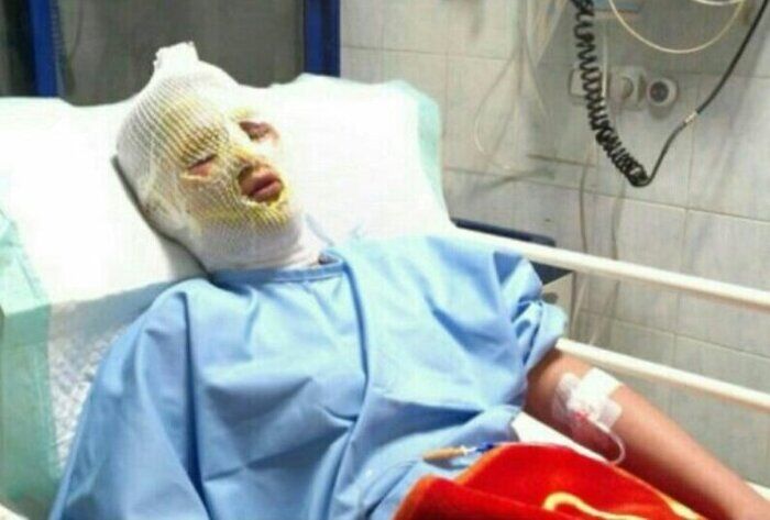 دشت ارژن در آتش ترقه: 3 جوان راهی بیمارستان شدند!