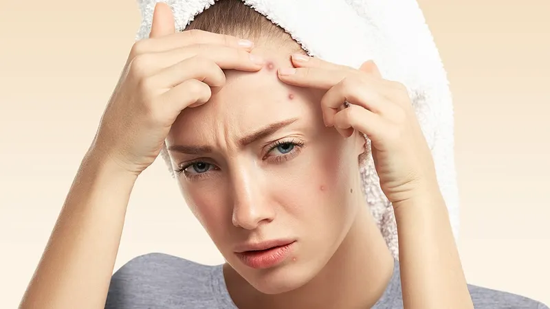 6 اشتباه در آرایش کردن که باعث جوش زدن صورت می شود