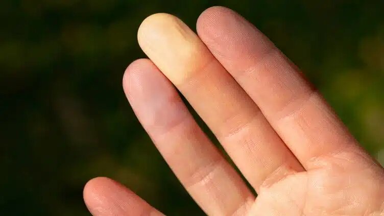 نوک انگشتان شما چه چیزی درمورد حال روحیتان می گوید؟