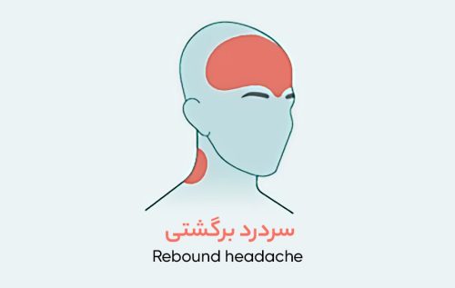 درد در هر بخش از سر نشانه‌ی چیست؟ انواع سردرد بر اساس محل درد