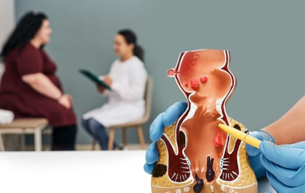symptoms fissure disease